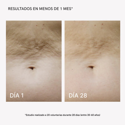 RF Tratamiento Flacidez Corporal